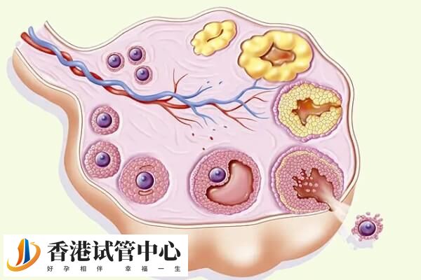 卵泡成熟打破卵針后仍然無法受孕只能做試管嬰兒了嗎？