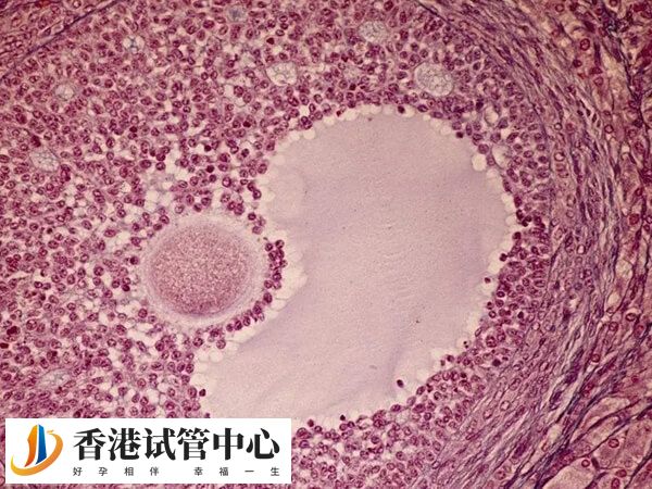 女性卵泡黃素化不排卵一定是因為中樞內分泌紊亂嗎？