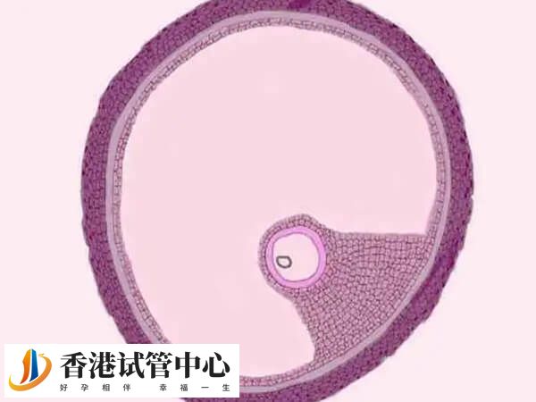 打促排針后卵泡不破且出現黃素化是因為垂體異常嗎？
