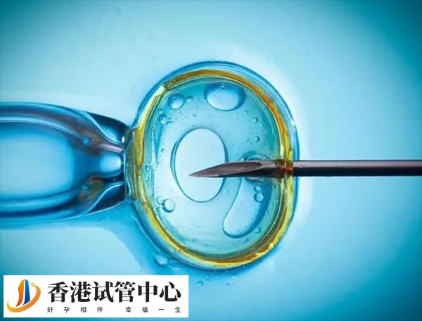 香港做試管嬰兒也需要滿足適應癥