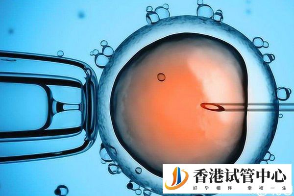 香港凍卵流程簡單