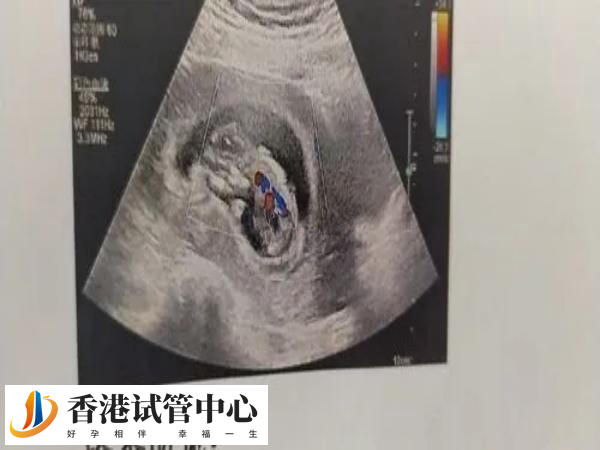 試管注射夜針前孕酮高會怎么樣