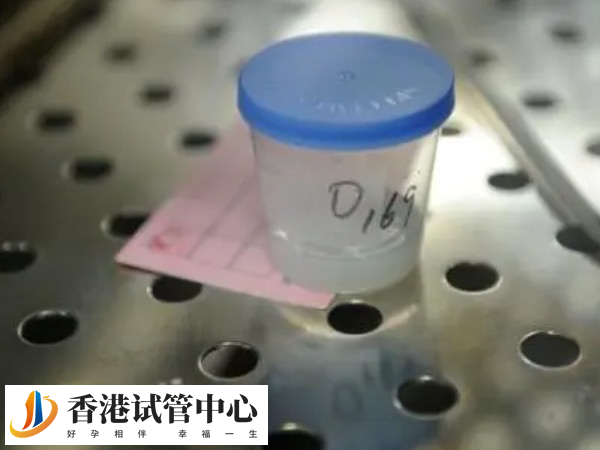 供精后代不是自己的要理解和接受血緣關系