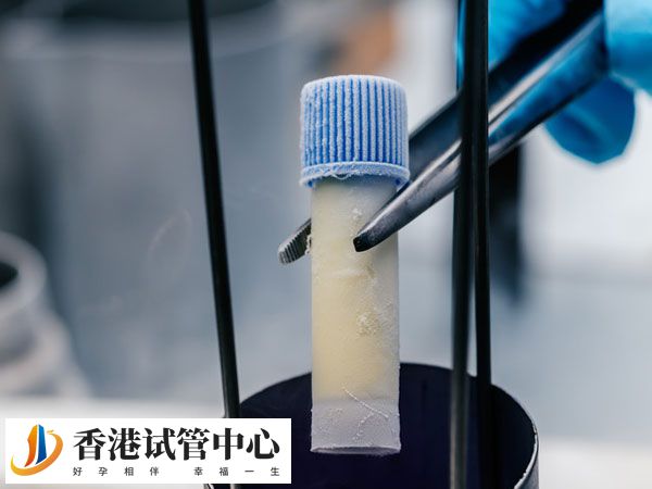 實施一次供精助孕價格多少