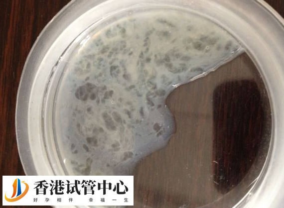 沒有用完的精源可以進行保留