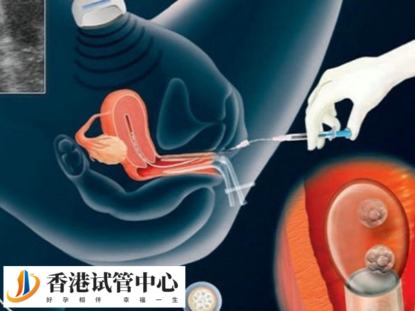 供精人工授精臨床數據不是很好