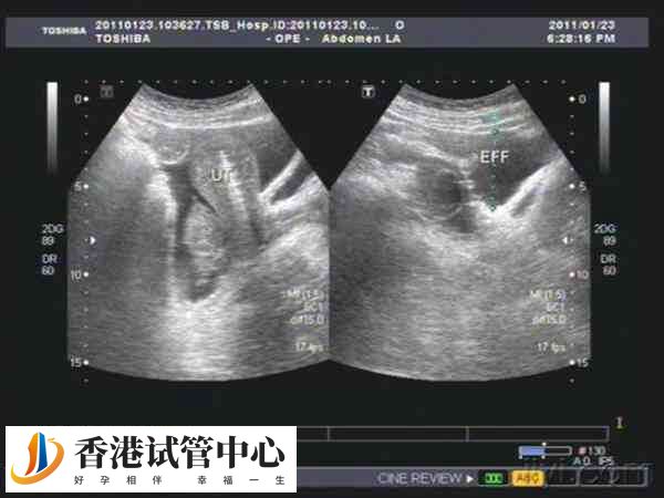 促排數(shù)量多有助于提高成功率