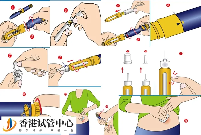 試管嬰兒促排打完普麗康能洗澡,注意沐浴水溫、時間很重要