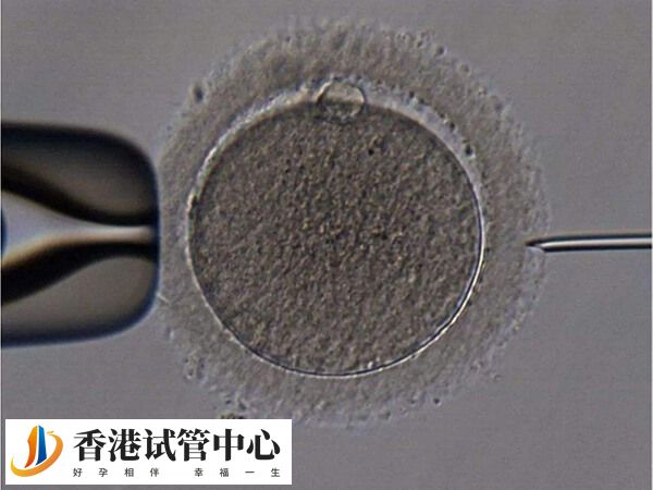 單精子注射技術可以幫助受精