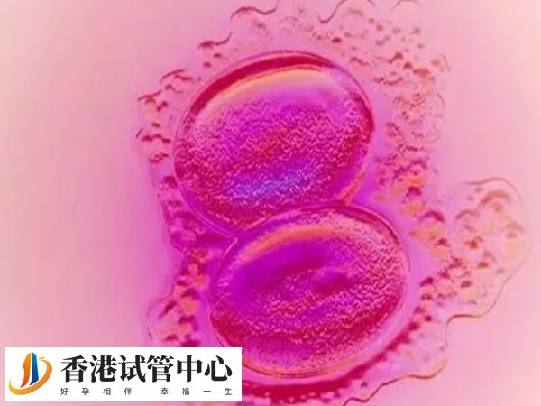 子宮內膜異位會影響胚胎著床