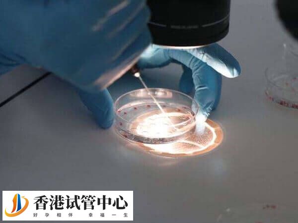 試管養囊要收費