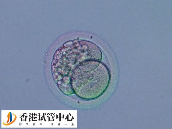 囊胚移植第七天白板是否正常