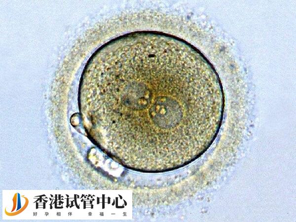 試管移植后生化了是什么原因