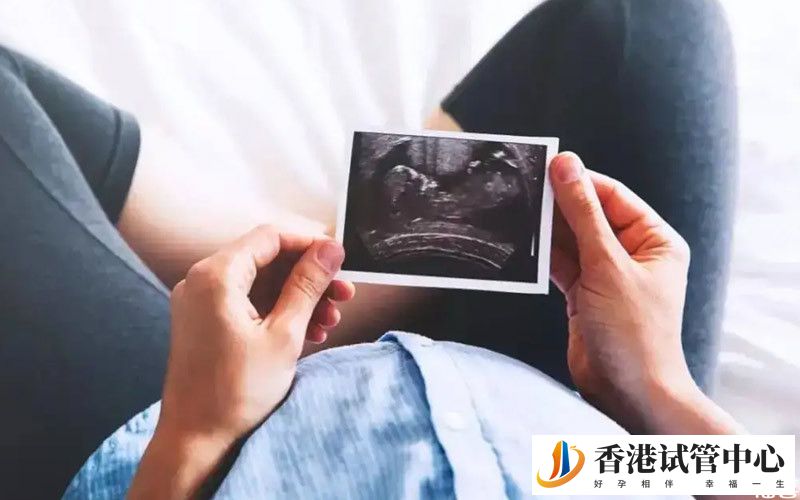 胎兒B超檢查報告單