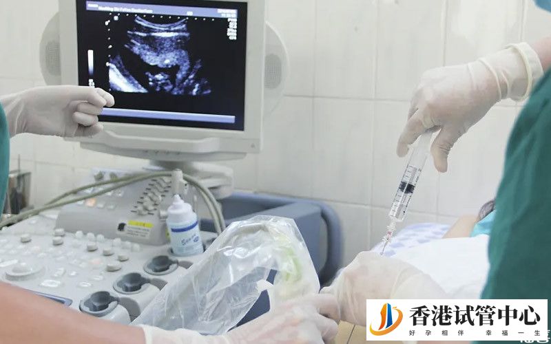 孕婦正在檢查身體