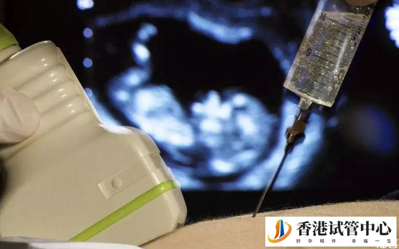 孕婦正在做羊水穿刺檢查
