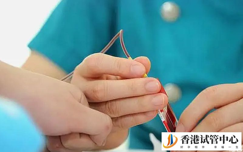 唐氏篩查三項正常值范圍參考