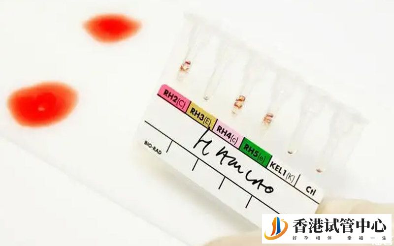 孕婦abo溶血標準值參考