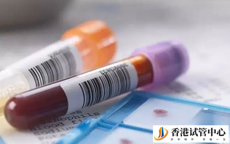 abo溶血要引起重視