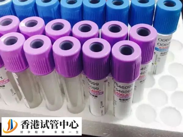 查FSH水平次數因人而異