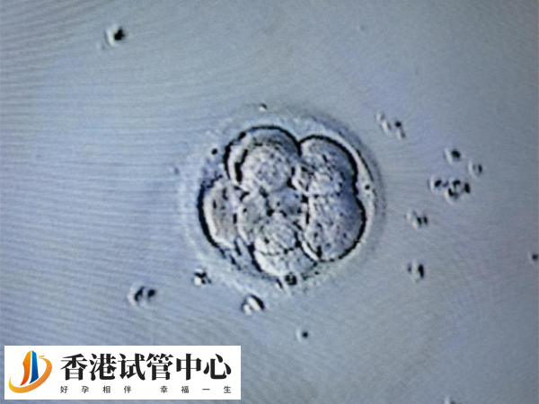 試管取卵幾個較好
