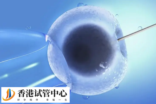 取卵后靜脈曲張襪要穿幾天