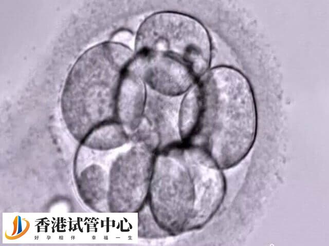 胚胎移植后hcg翻倍好為何還出血了