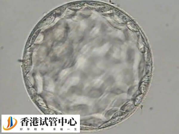 胚胎移植后hcg翻倍好但胸不漲很正常