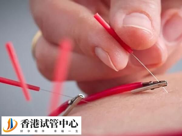 試管促排期間用電針好不好