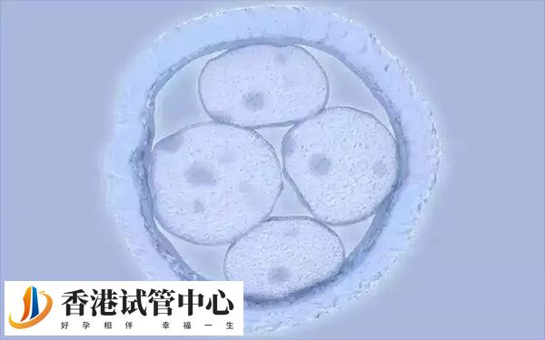 年齡是影響試管嬰兒成功率中最重要的因素之一