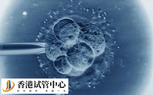 養(yǎng)囊是一個(gè)優(yōu)勝劣汰的過程