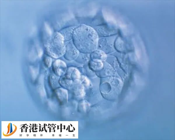 囊胚異常移植之后可能會失敗