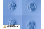 4cc等級的囊胚質量差，胚胎后移植成功率